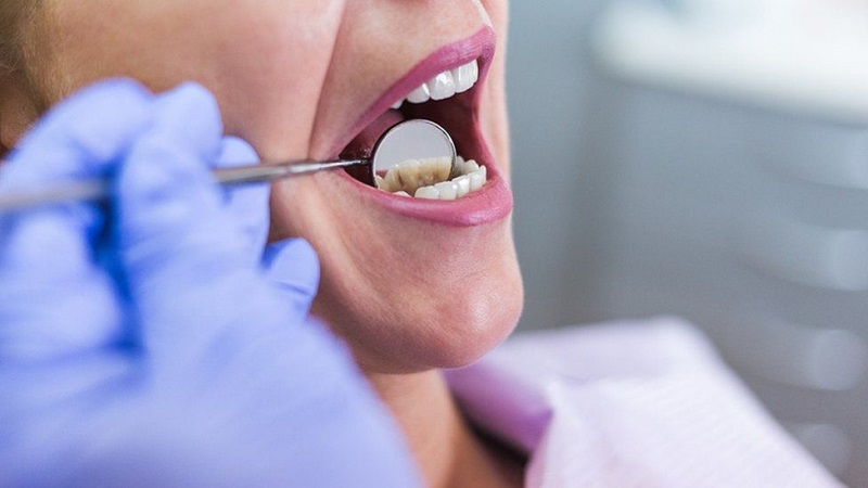 Why You Need To See Your Dentist Regularly